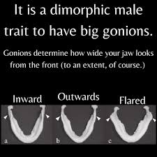 Outward gonions John-Erik Hexum ...
