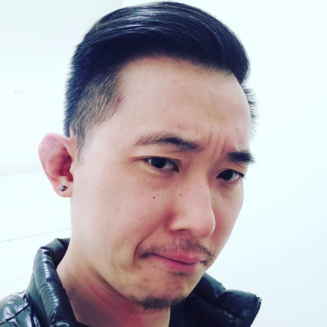 Real life example of huanghoid phenotype v0 3fhc6mkv486e1