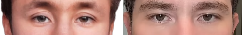 Eye area improvement