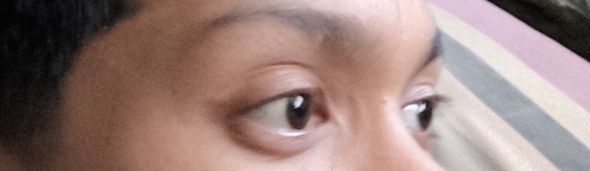 1000018237