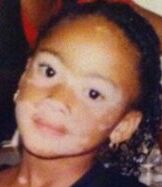 151204114619 winnie harlow childhood photo 2 1
