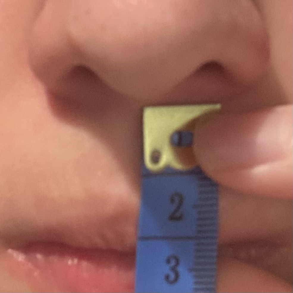 Philtrum measured