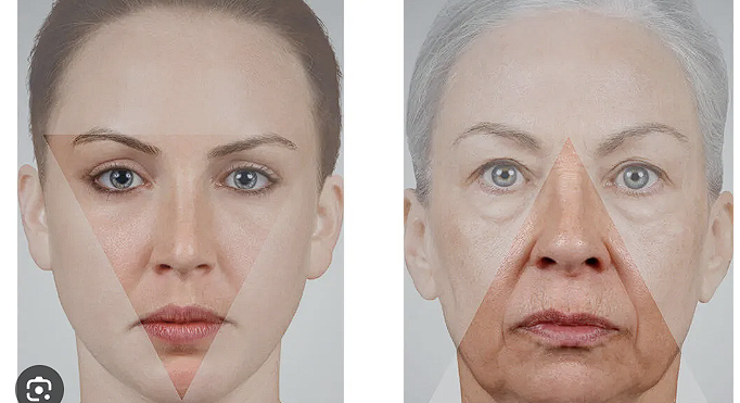 Aging2