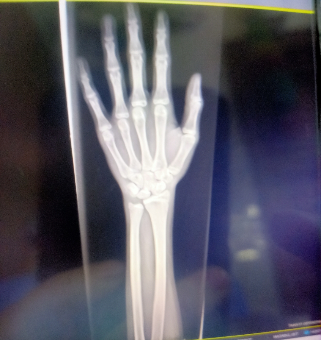 Screenshot 2026 02 11 18 02 24 75 99c04817c0de5652397fc8b56c3b3817