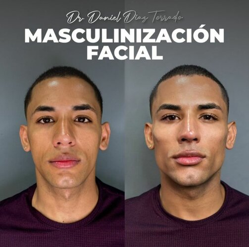 3912593 20240125 150821