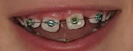 IMG 20260222 1329461