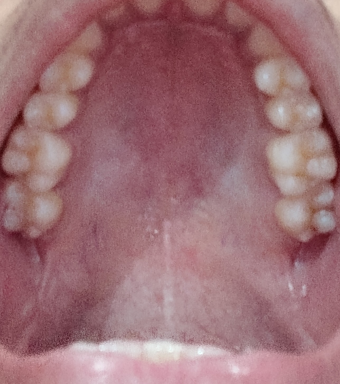 IMG 20260223 003056 9932