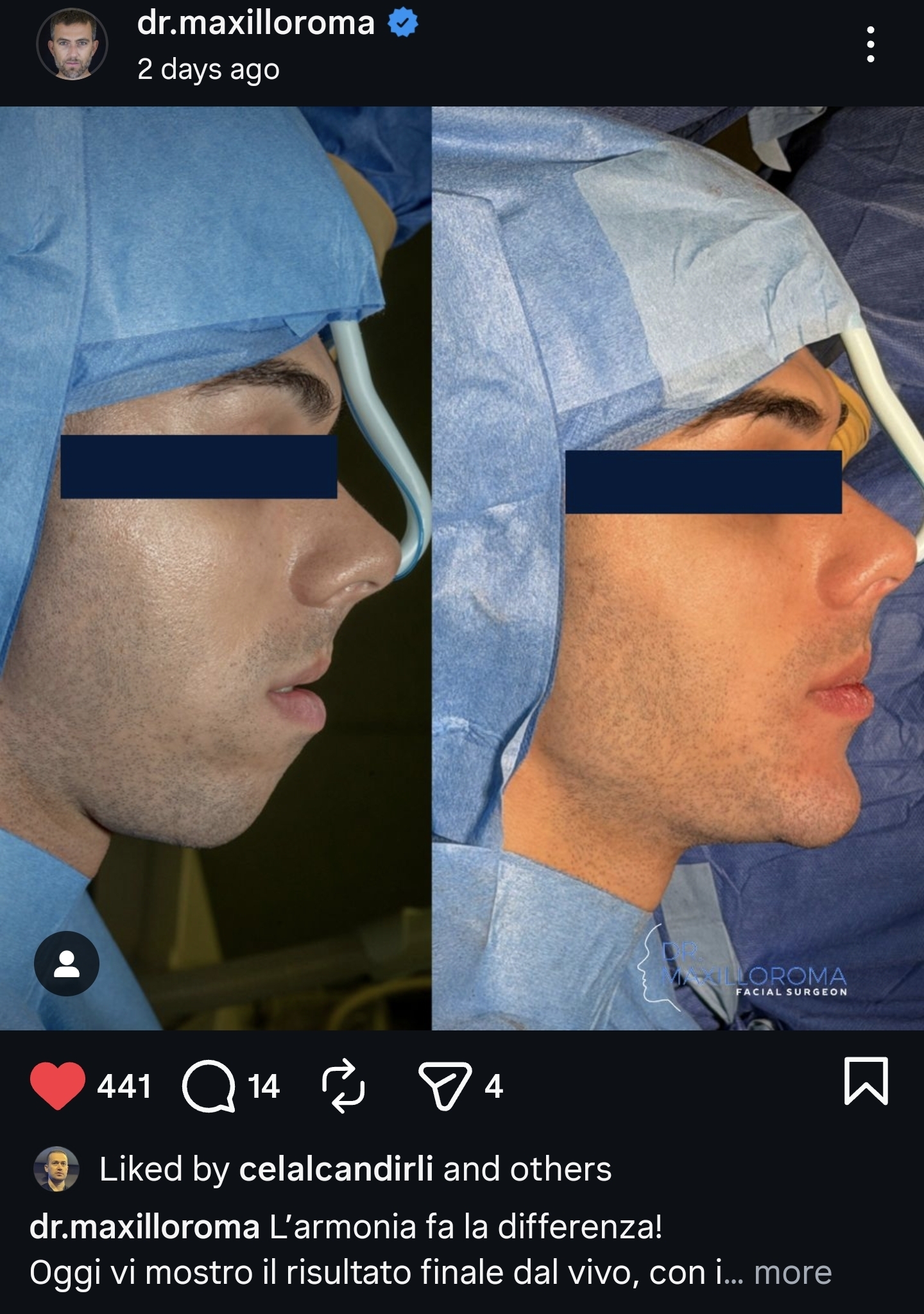 Screenshot 20260112 040039 Instagram