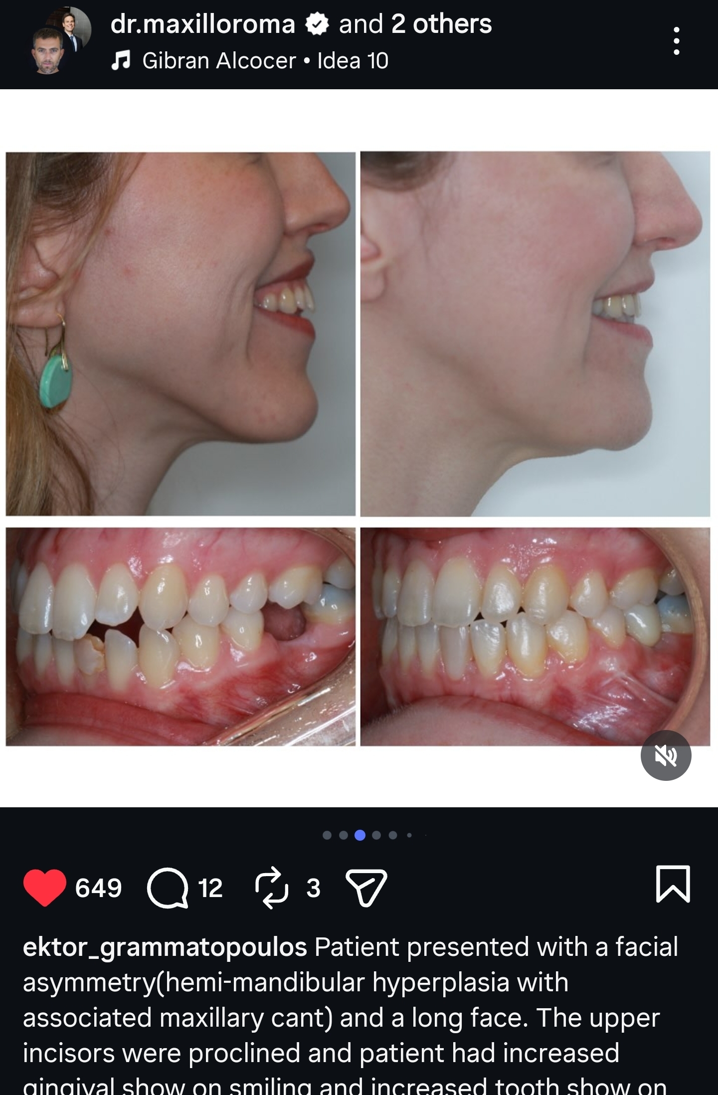 Screenshot 20260112 040107 Instagram