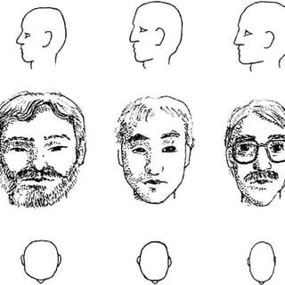 2357945 Head shape variations persist into adulthood Reprinted with permission from Mooney MP 
