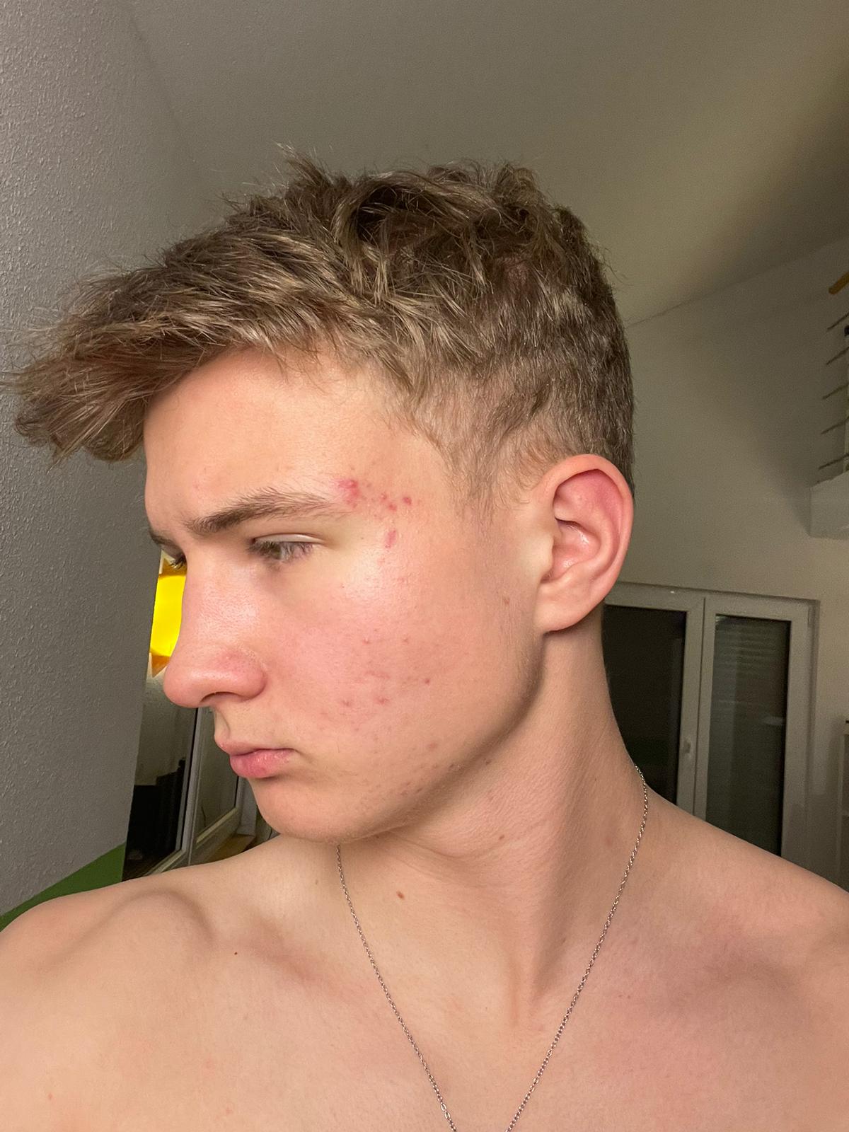 Angledprofile