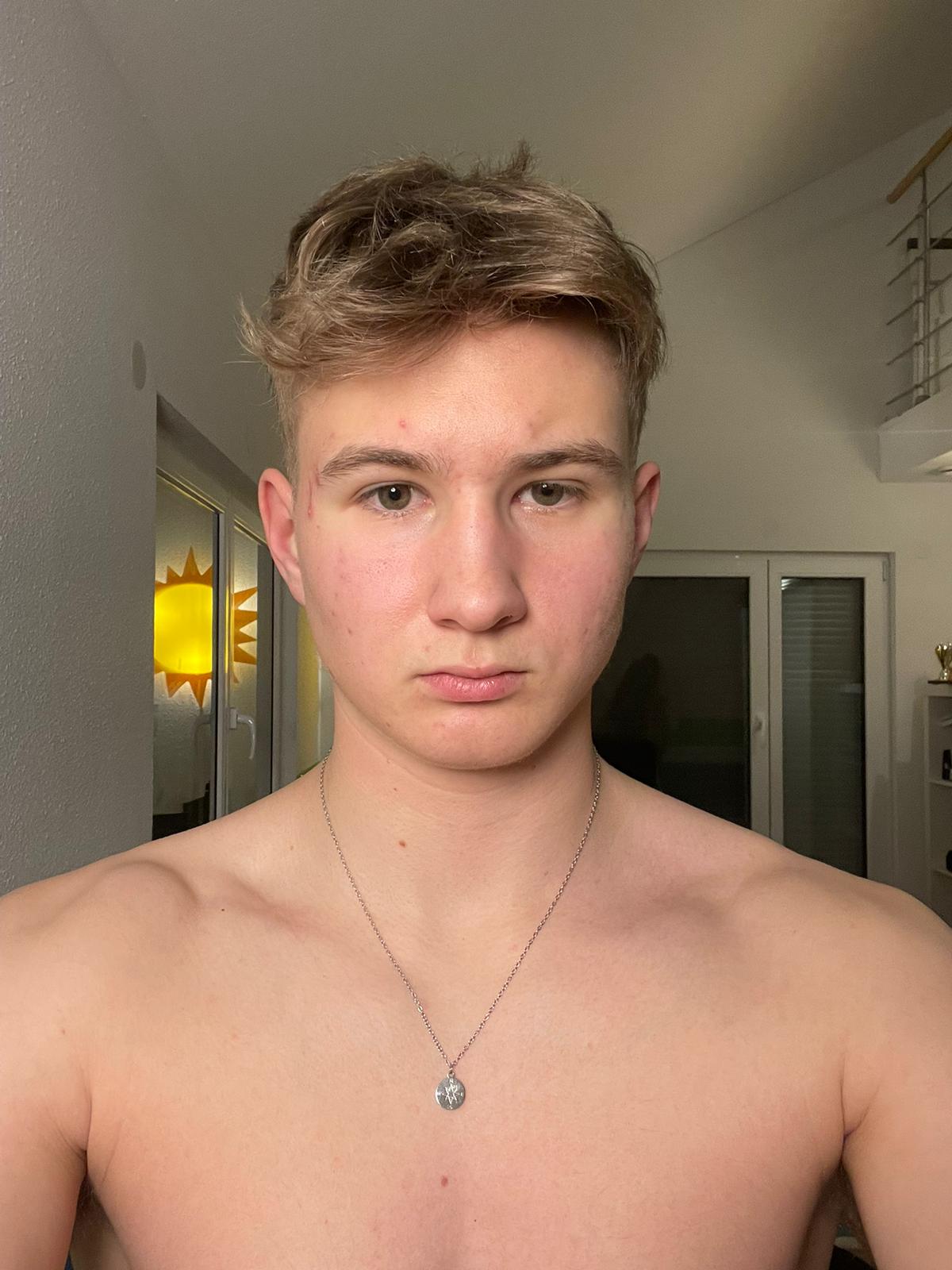 Frontprofile
