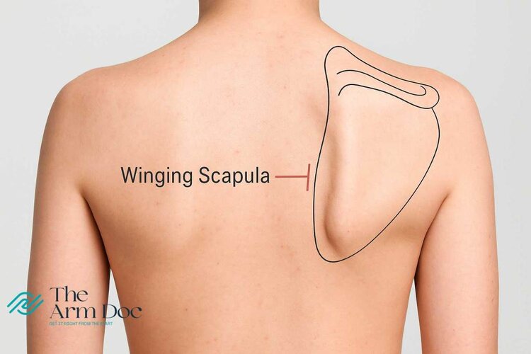 Scapular-Winging.jpg