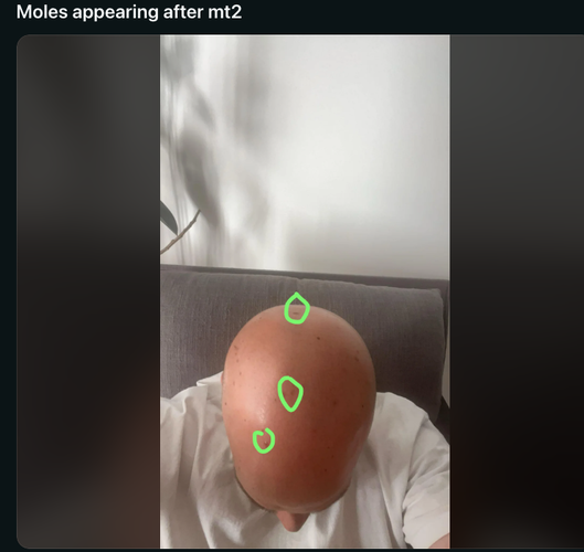 Capture d’écran 2026-02-03 à 17.23.22.png