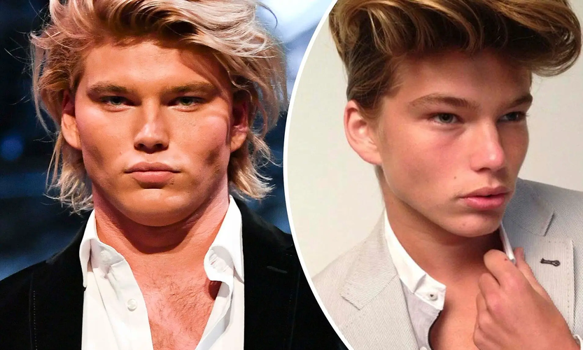 Jordan Barretts Plastic Surgery21 1