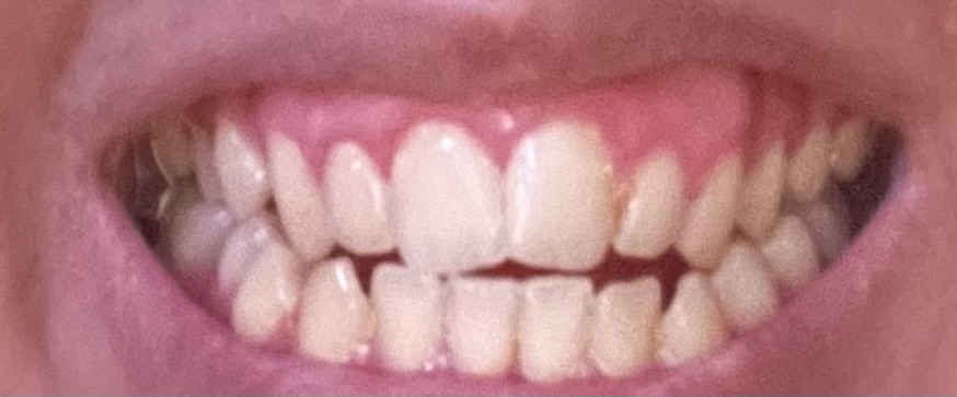 teeth.png