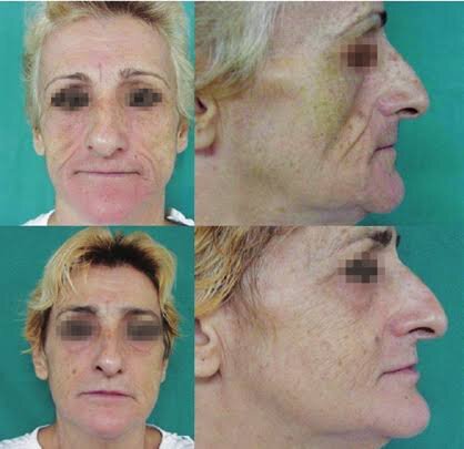 images - 2026-02-25T064653.665.jpeg