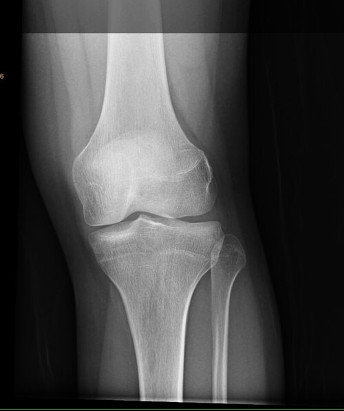 DashKneeXray_2.jpeg