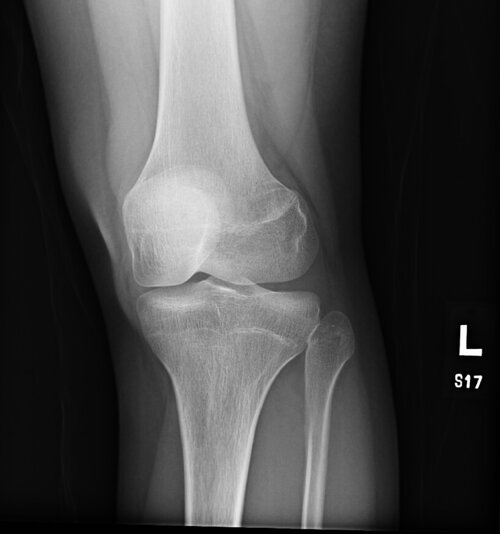 DashKneeXray_1.jpeg