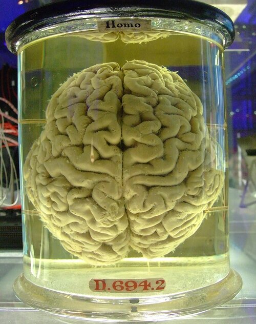 Human brain in a vat