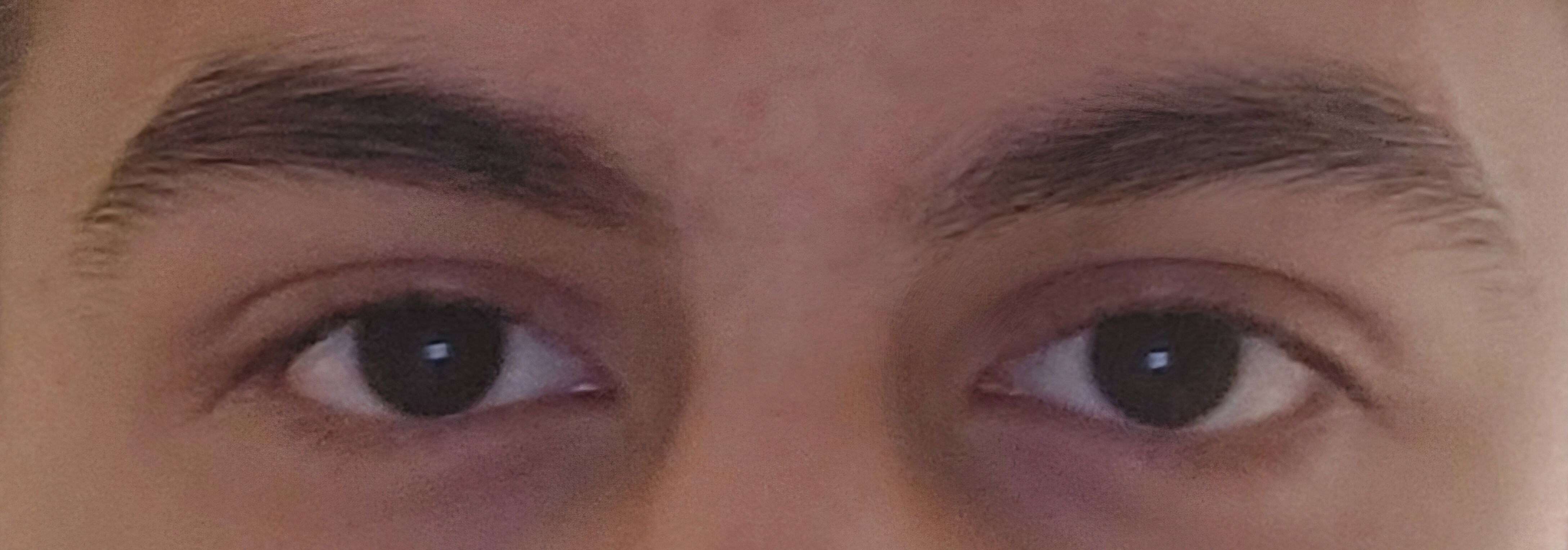 1000117644