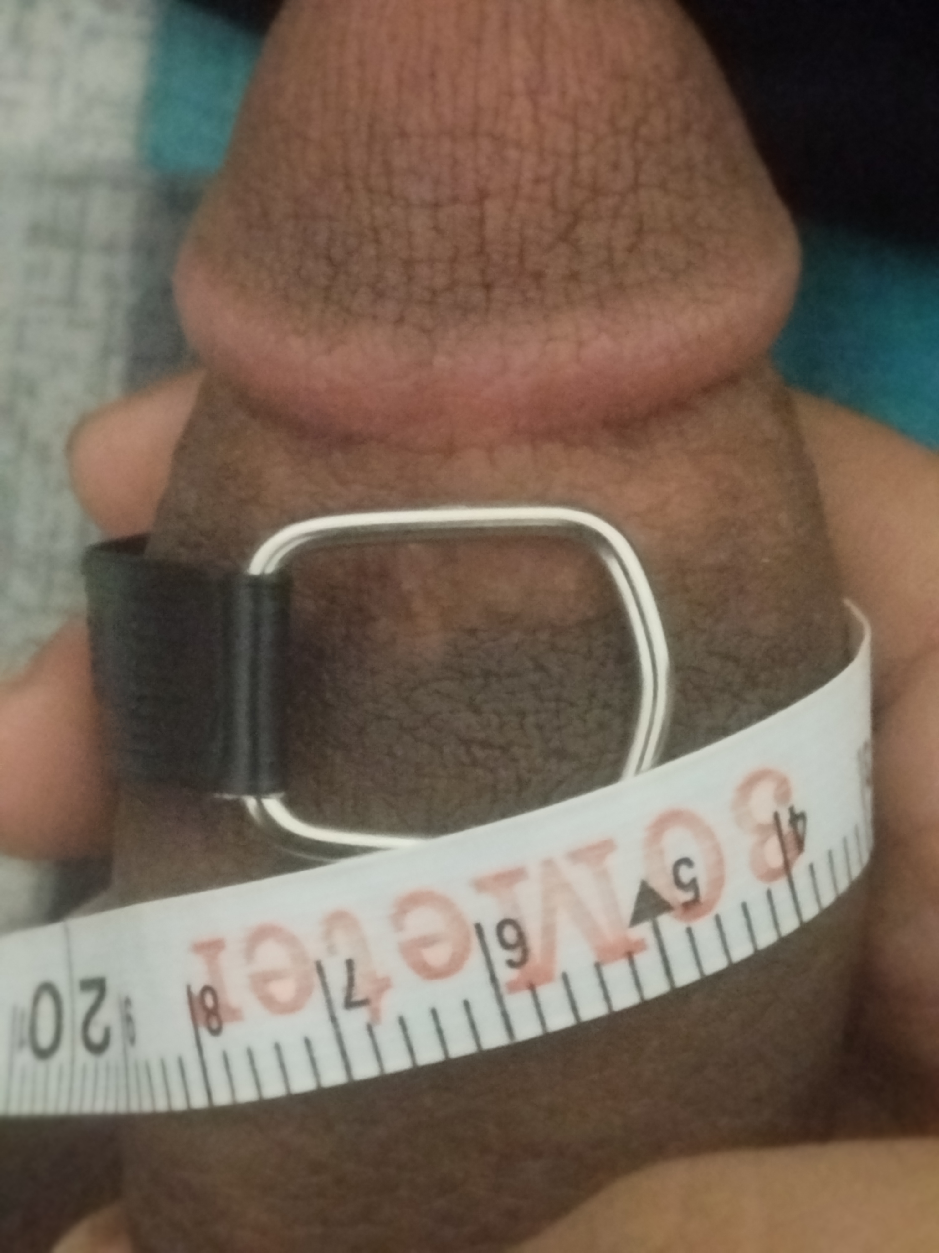 1000026565