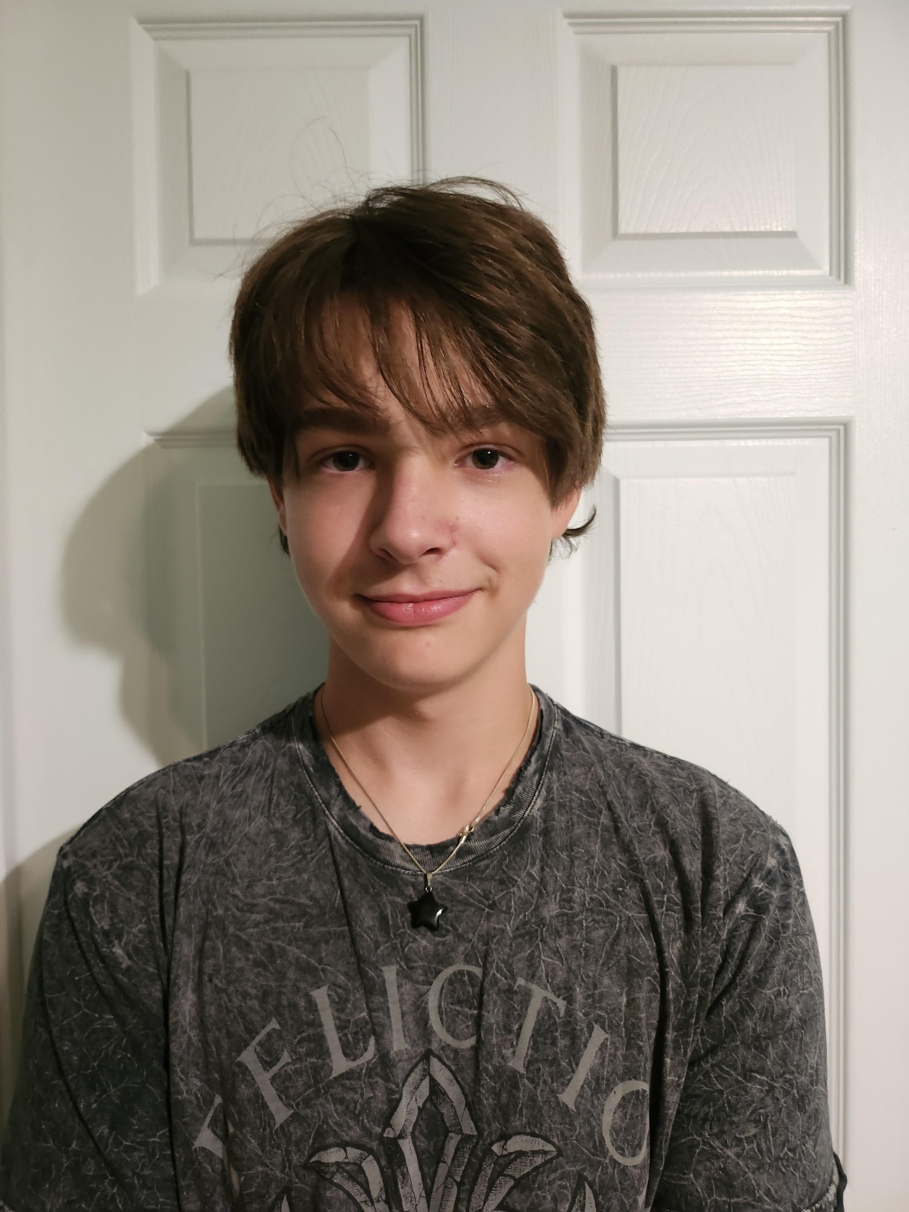 16 year old male and i think im ugly v0 jsyth70g6ckb1