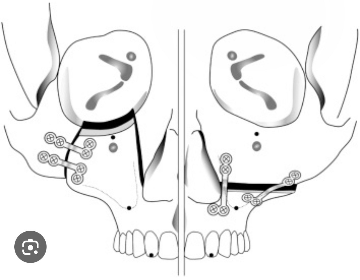 C82C6C6B D8EE 4CB6 AD21 ED2534BADDB1