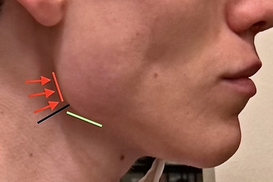 105141CC 50EF 479E 9755 59ED6D96CB22 1 201 a