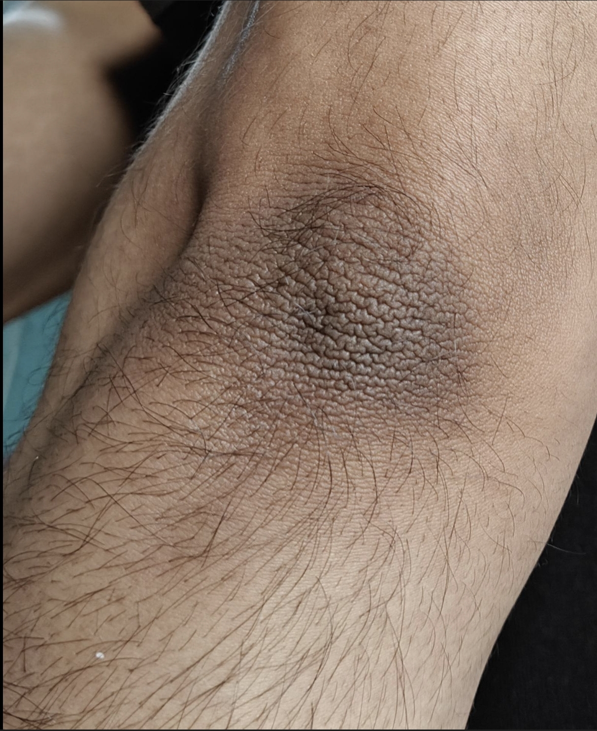 Screenshot 20260305 203048 com google android googlequicksearchbox GoogleAppActivi