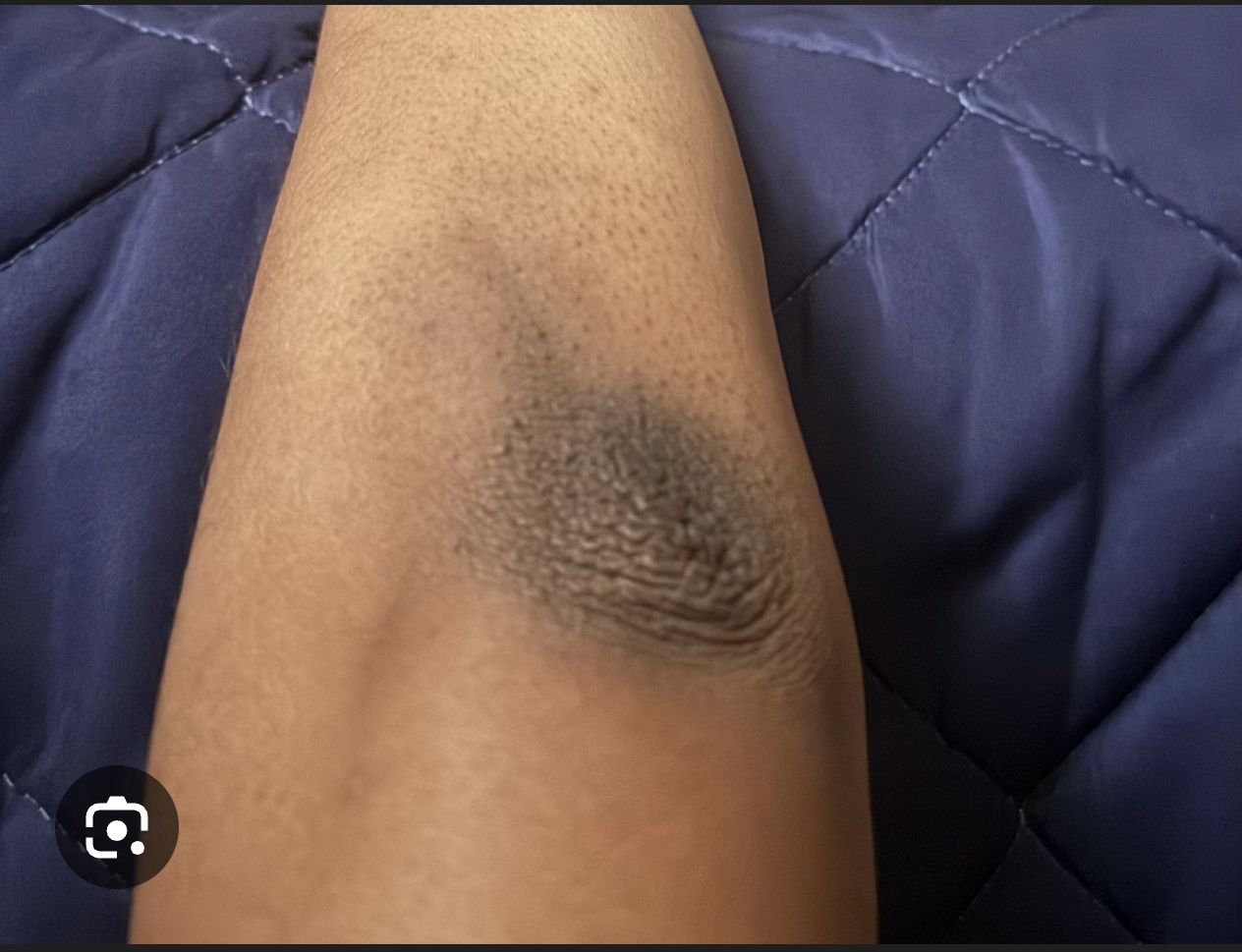 Screenshot 20260305 203034 com google android googlequicksearchbox GoogleAppActivi