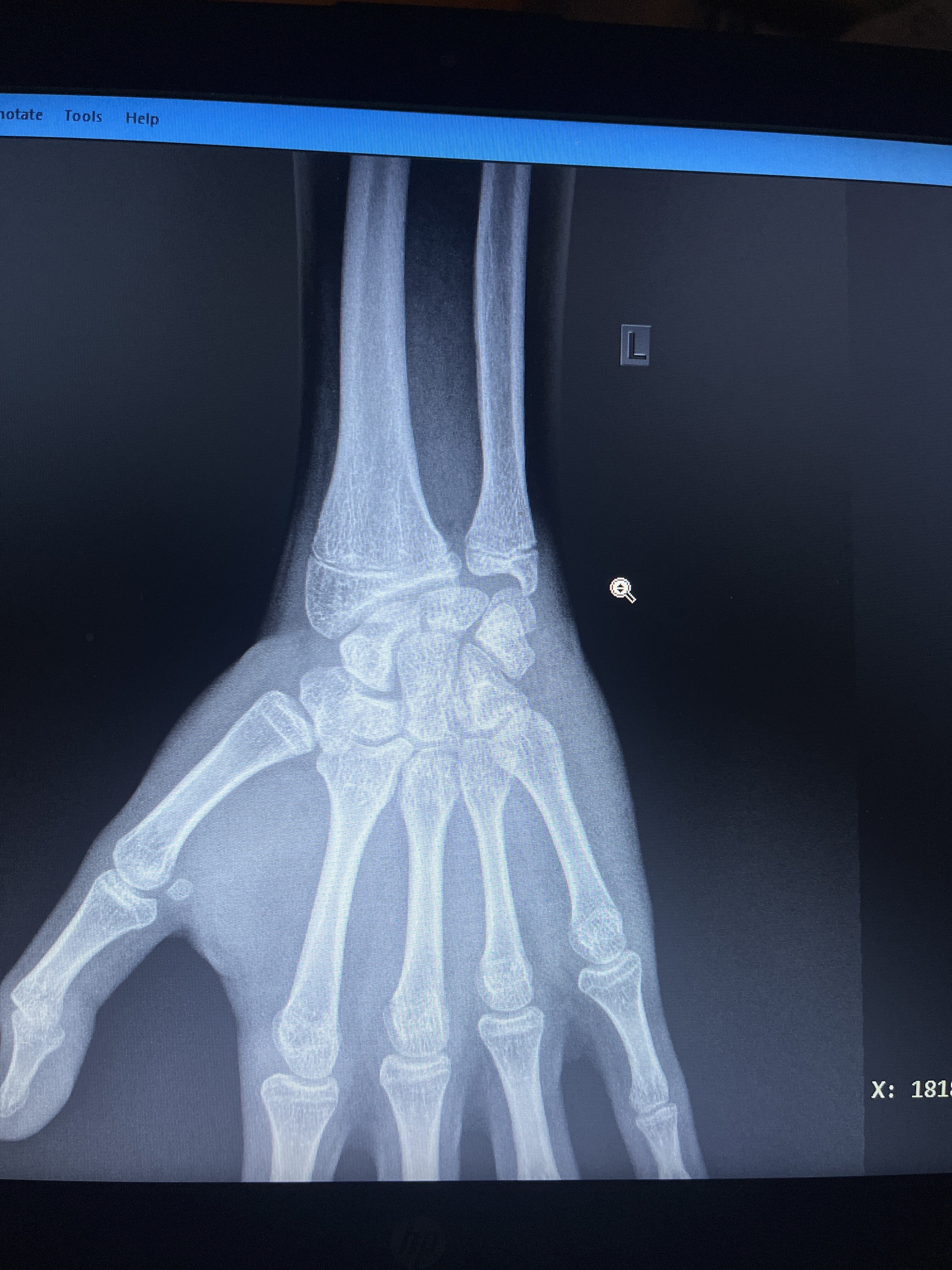 IMG 0921CE94 DD72 4133 97A1 330C314F9973