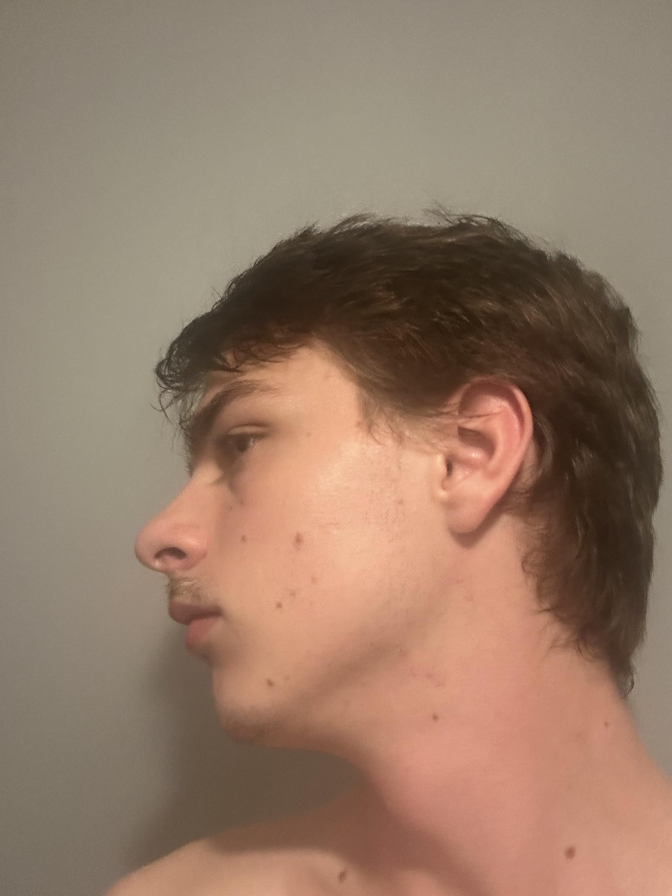 Never liked my side profile and feel like i look weird any v0 13e7kmazvmsf1
