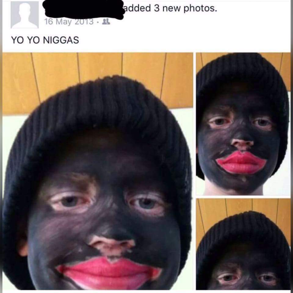 1000143386