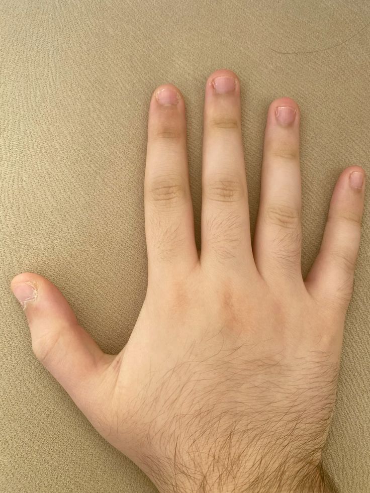 91780083d1b77ae9fc7a62e3a28fedc2