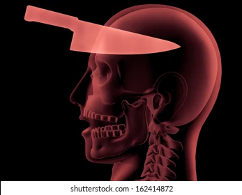 3d xray human head shows 260nw 162414872