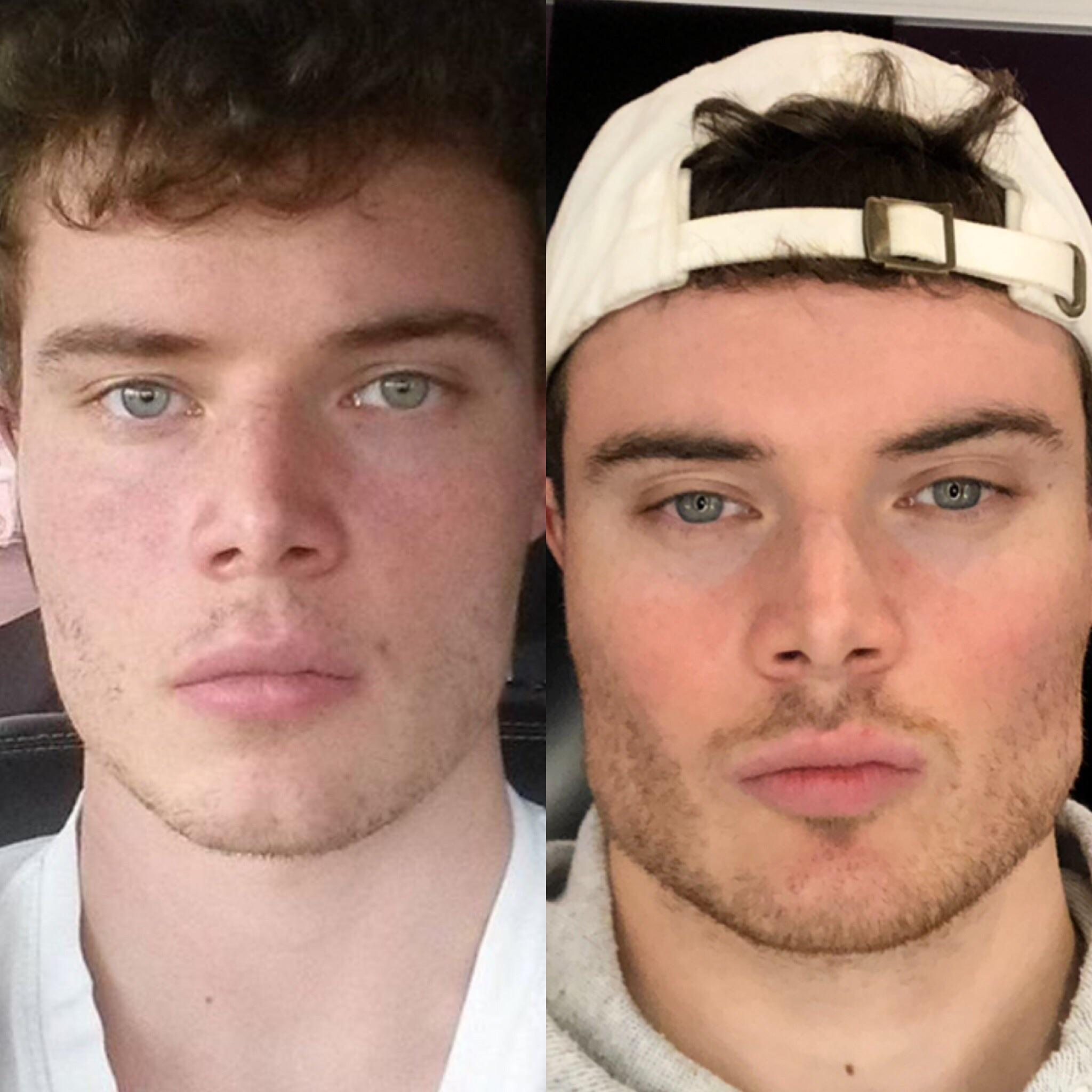 left is mid ascension at 19 or 20, right is 22
