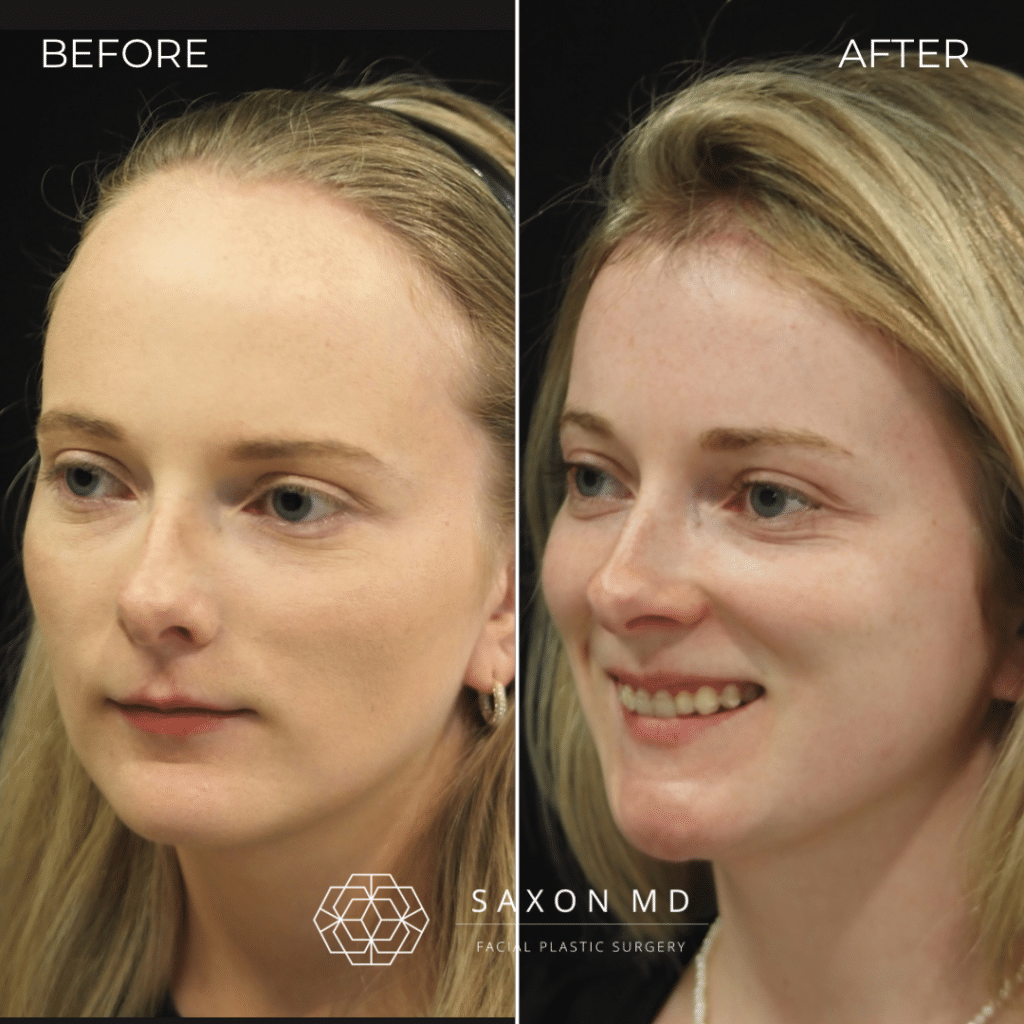 5809805 78DC371A 99A6 4B9C 80FD 7ED975C2AD4F 1 1024x1024