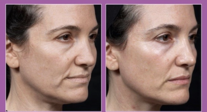 Screenshot 2026 03 15 at 94626PM