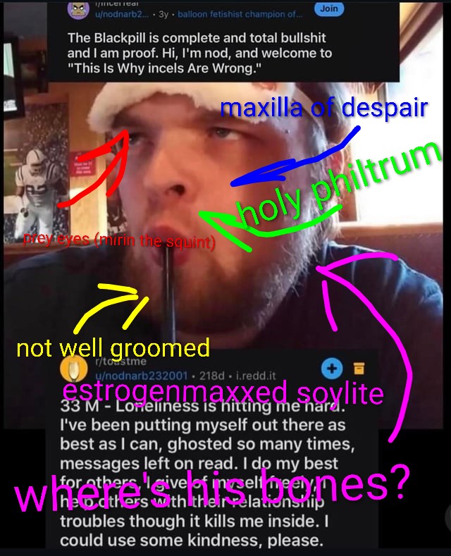 Looksmaxxing incels mocking the suicide of a fellow r v0 sr94m0s4kepg12