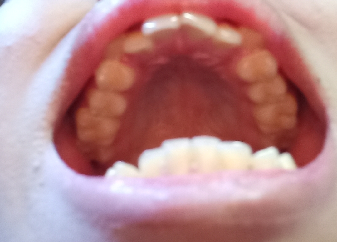 Screenshot 2026 03 17 22 42 29 92 99c04817c0de5652397fc8b56c3b3817