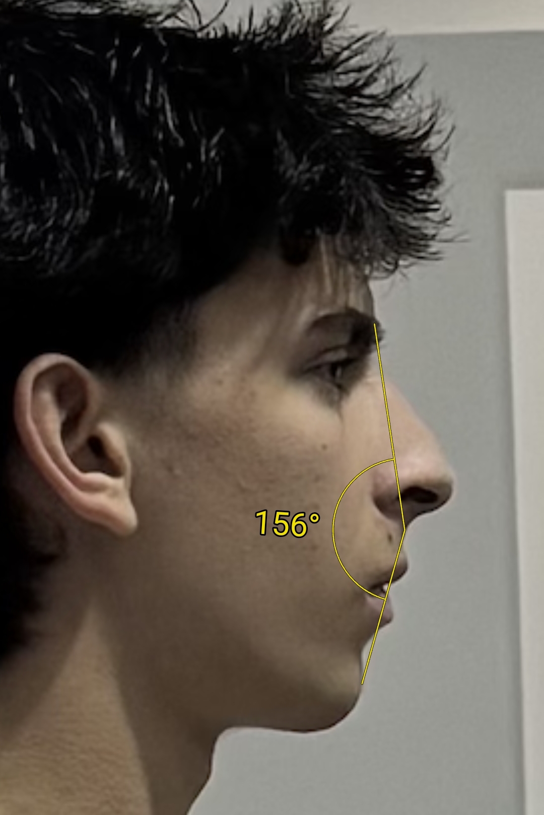 Screenshot 2026 03 18 03 09 26 549 dedirkfarinimagemeter edit