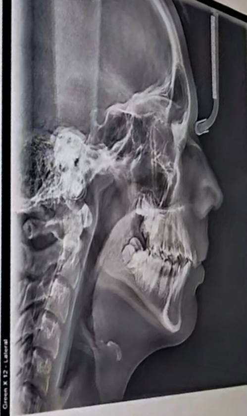 6004926 Screenshot 20251103 153902 Messages