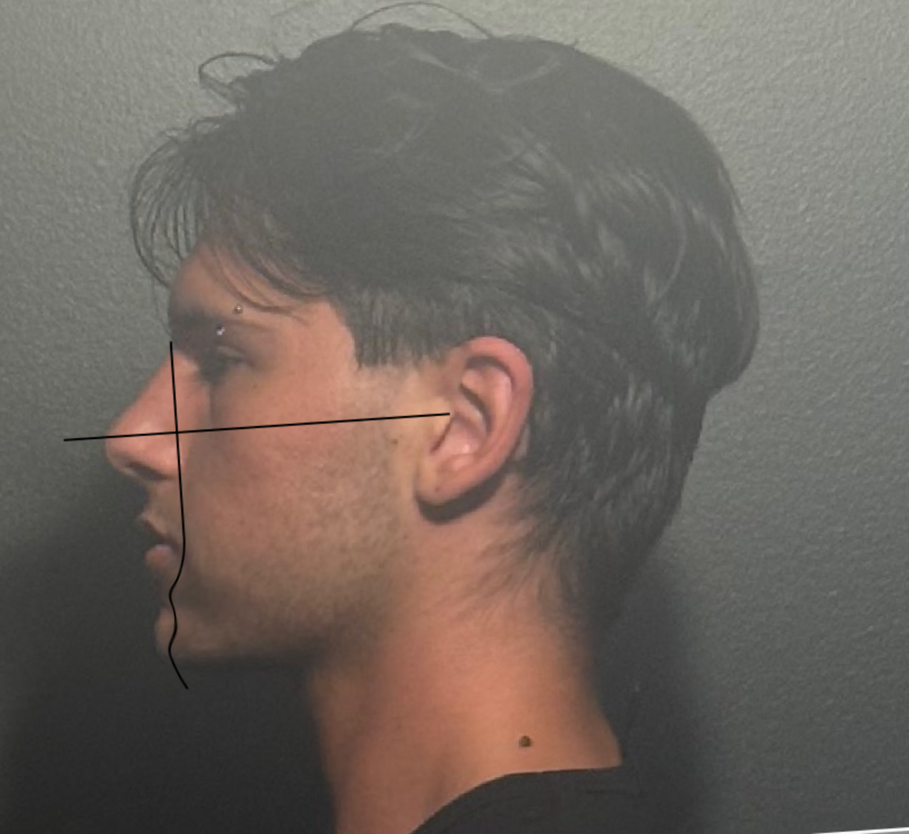 B612 20260318 111617 470