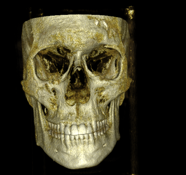 Screenshot 2026 03 19 alle 170444