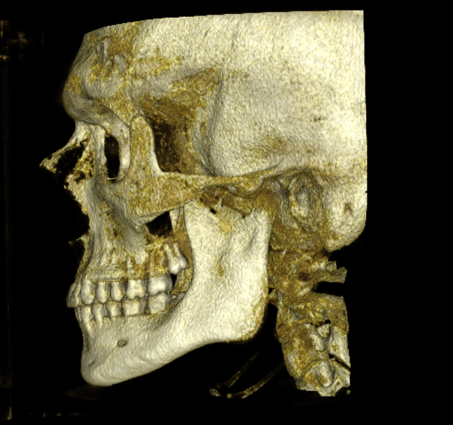 Screenshot 2026 03 19 alle 170500