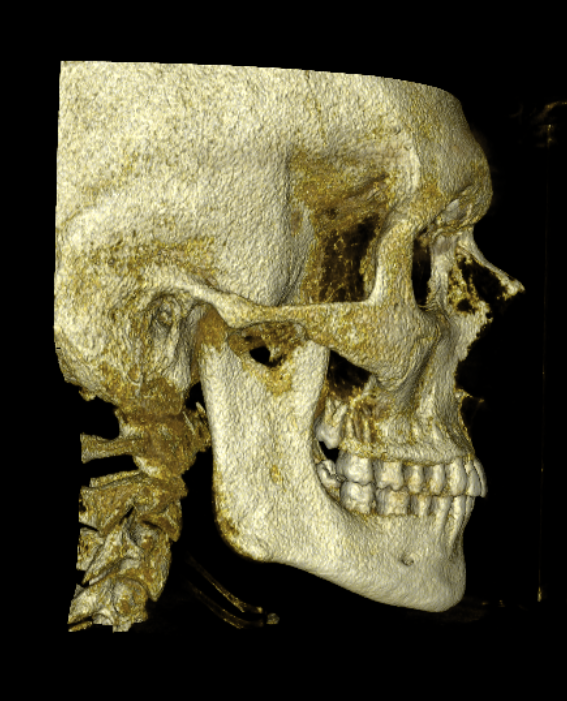 Screenshot 2026 03 19 alle 170509