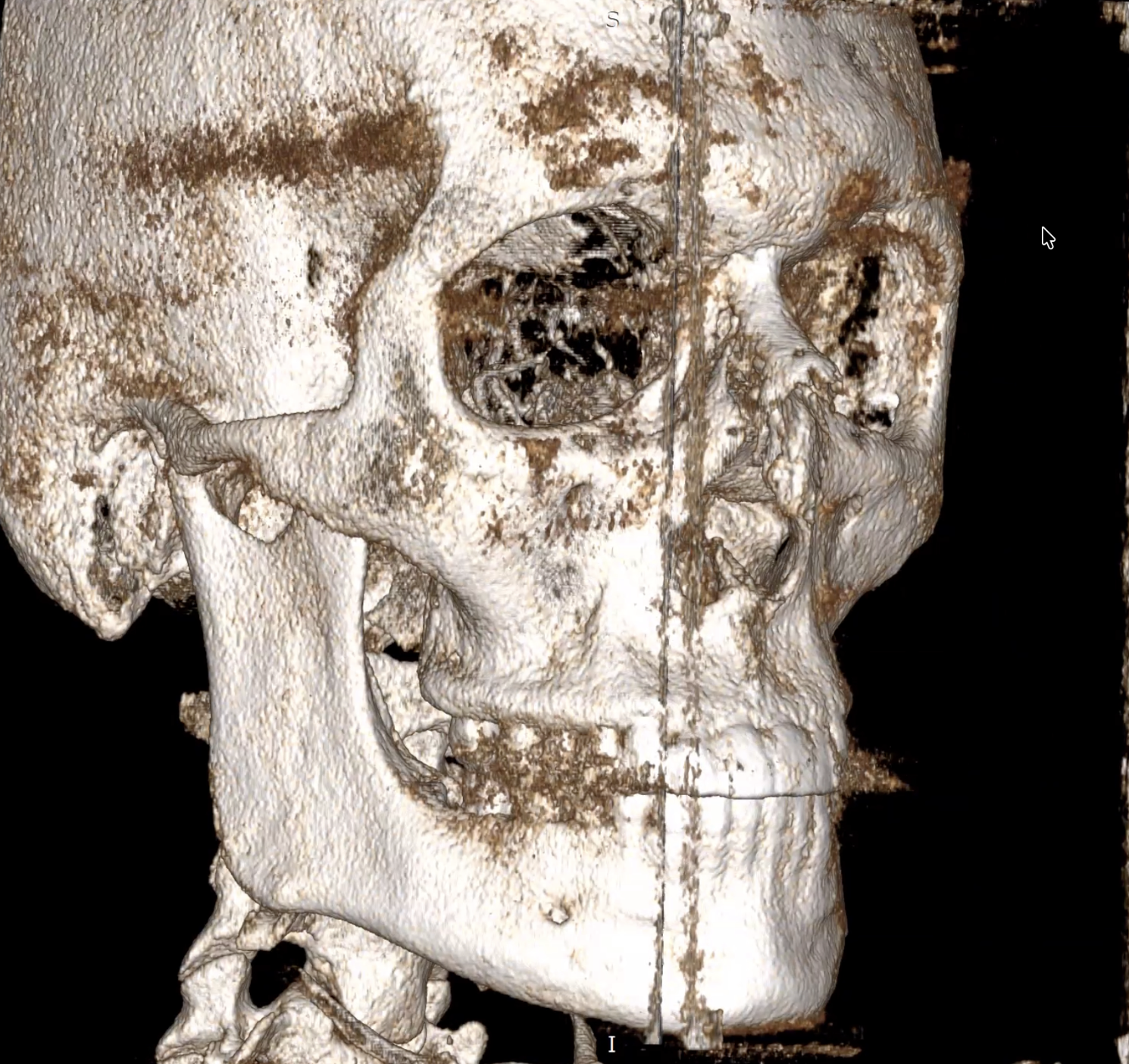 Screenshot 2026 03 23 alle 181949