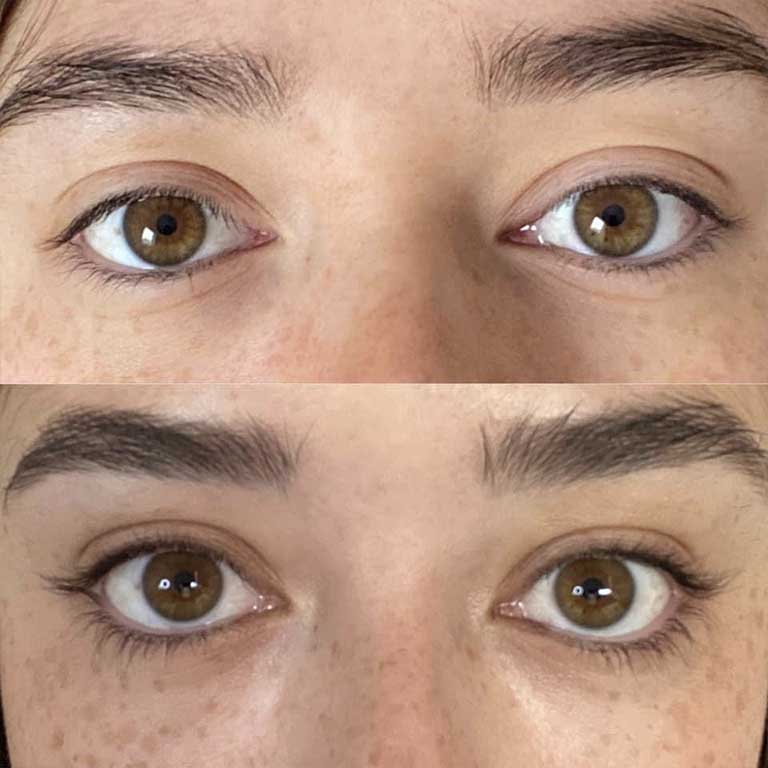 20 before and after lashes