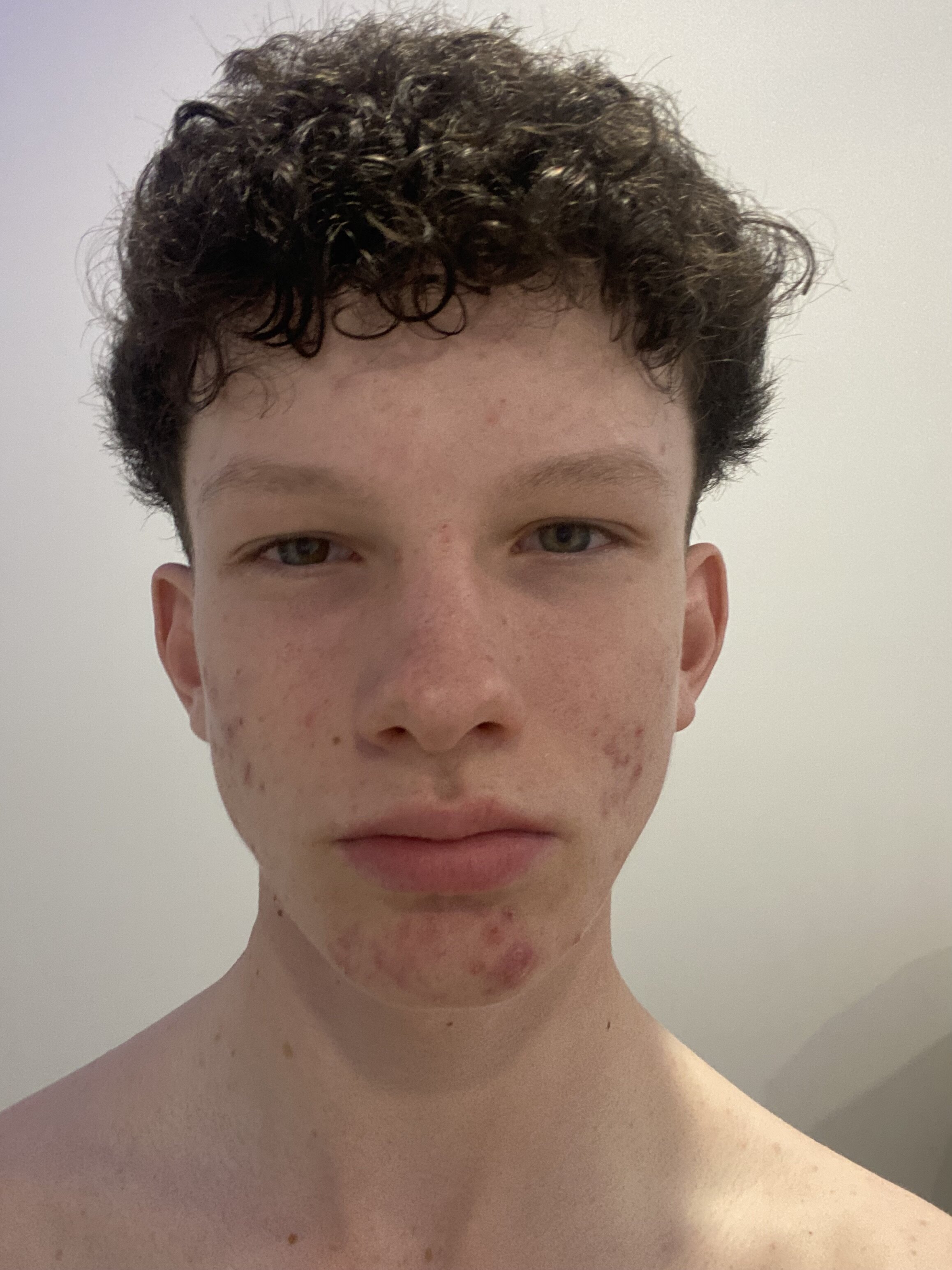 IMG 0155